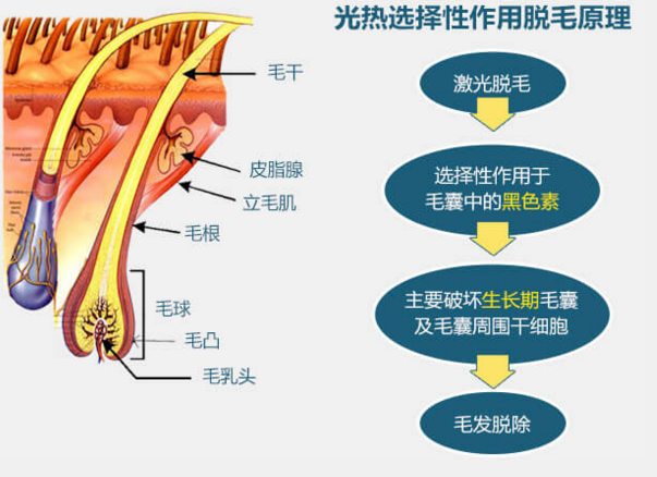 深圳激光脫毛對(duì)皮膚危害性大嗎