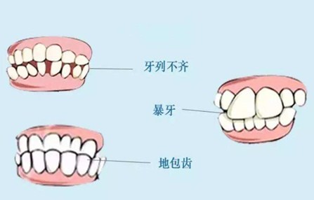 牙齒矯正整形