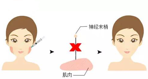 杭州瘦臉價(jià)格大概是多少