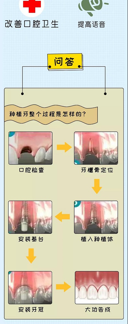 牙齒矯正可以用一輩子嗎？