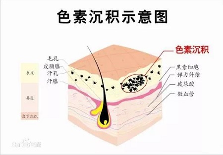 盤點(diǎn)四種需要來一針的膚質(zhì)