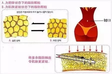 四月不吸脂，五、六、七月徒傷悲......