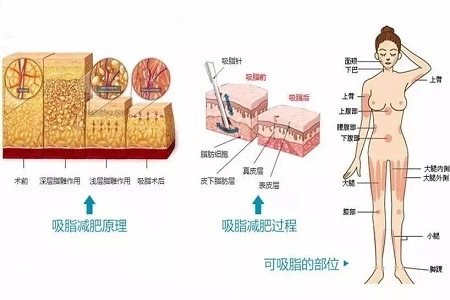 四月不吸脂，五、六、七月徒傷悲......