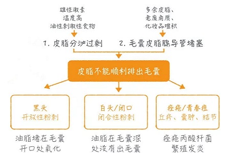 擠痘竟然被送進(jìn)ICU！你的痘痘還好嗎？