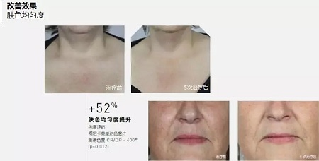 抗衰老的“水光”究竟為何飽受稱贊？