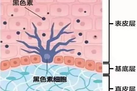 祛斑偏方“害死人”，小仙女們可長點(diǎn)心吧！