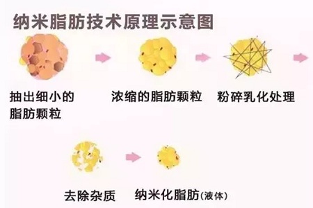 拿什么拯救你，我的黑眼圈？