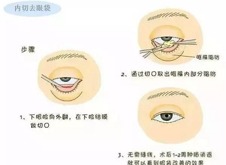 還把眼袋當(dāng)臥蠶？那就別怪小弟弟喊你阿姨了