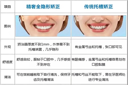 這種牙齒矯正方式，96%的人都會選擇！