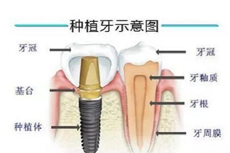 揭秘牙齒矯正的全過(guò)程！??！