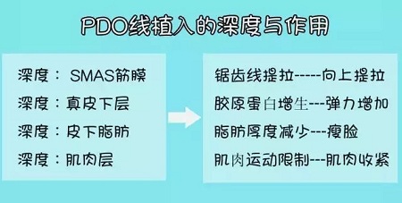 關(guān)于*雕，你想了解的都在這里！