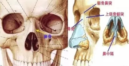 側(cè)面看鼻梁不矮,正面看鼻子卻很塌是什么原因？