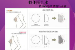 鄭州美萊 假體豐胸 給你傲人雙峰