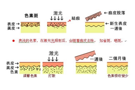 祛斑方法有哪幾種？這些祛斑小妙招你需要掌握