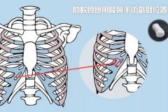 深圳隆鼻醫(yī)院做軟骨隆鼻多少錢，術(shù)后安全嗎